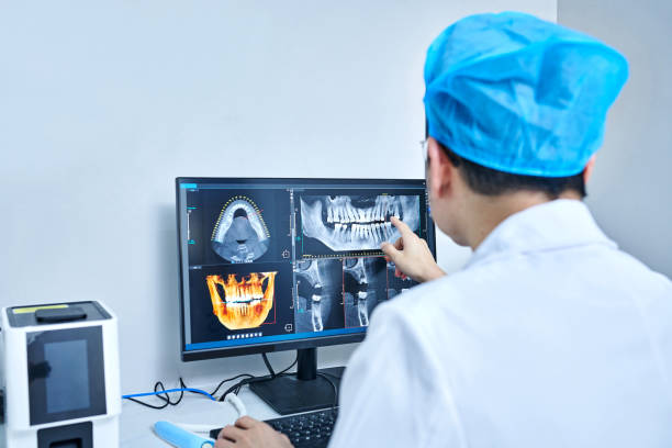 Best Emergency Dentist for Lost Fillings or Crowns in Orient, NY